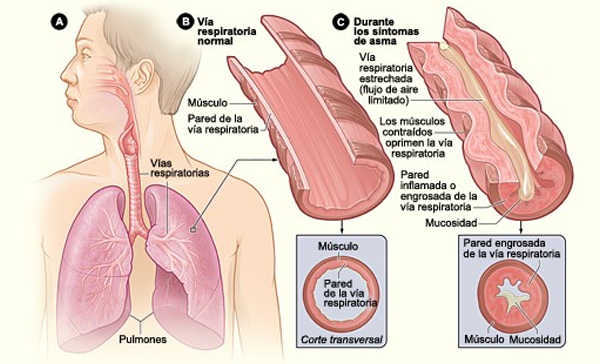 neumologia especialistas