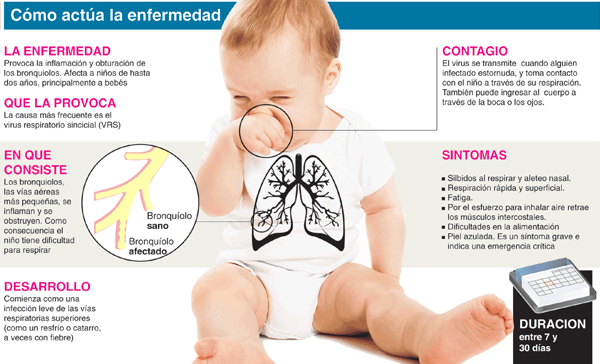 Bronquiolitis Monterrey