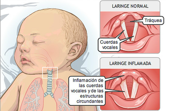 neumólogo en monterrey