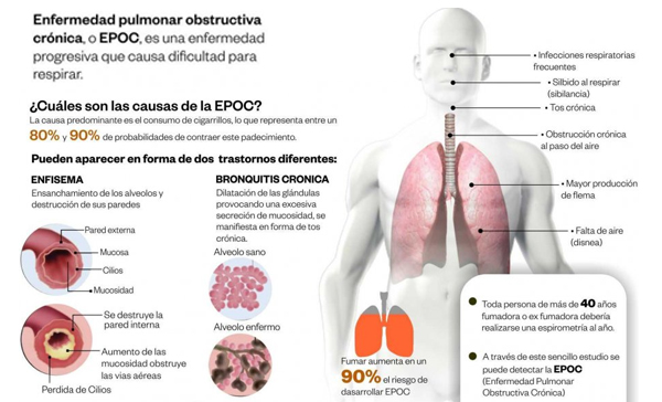 neumologia especialistas